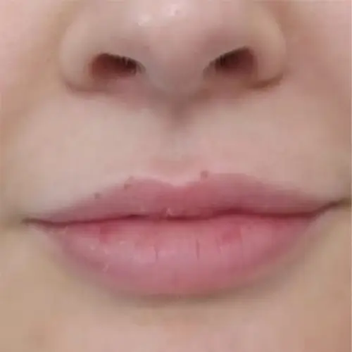 lip (4) (1) (1)